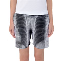 X Ray Women s Basketball Shorts by Valentinaart